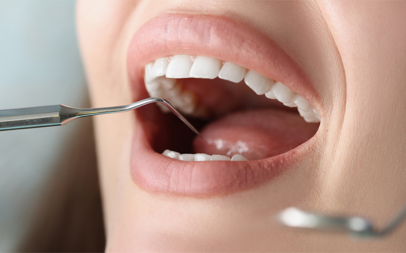 Dental hygienist treating a patient at Northdene Dental Surgery, Guildford