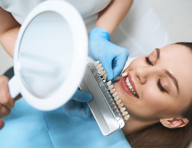 Veneers